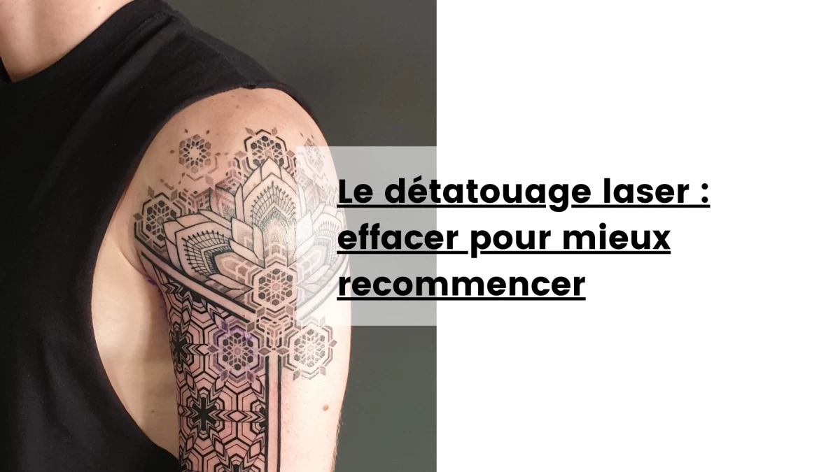 Le détatouage laser _ effacer pour mieux recommencer